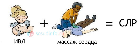Техника и порядок проведения сердечно-легочной реанимации при дтп