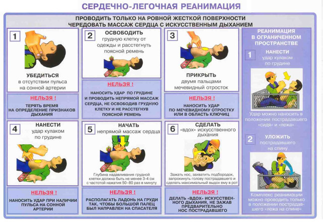 Техника и порядок проведения сердечно-легочной реанимации при дтп