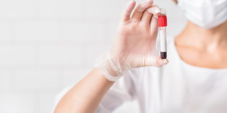 Анализ крови на кальций: показания и подготовка к сдаче анализа