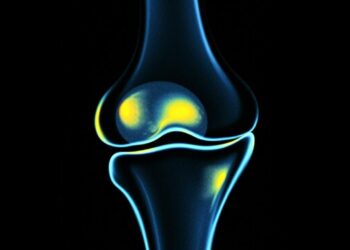 Когда ребенку назначают МРТ коленного сустава