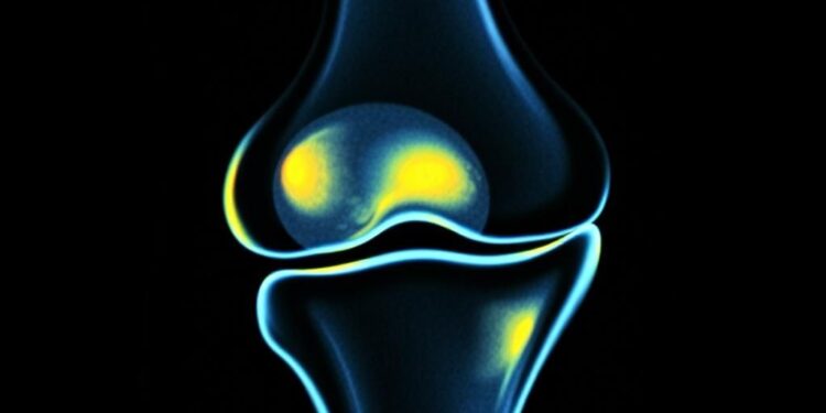 Когда ребенку назначают МРТ коленного сустава